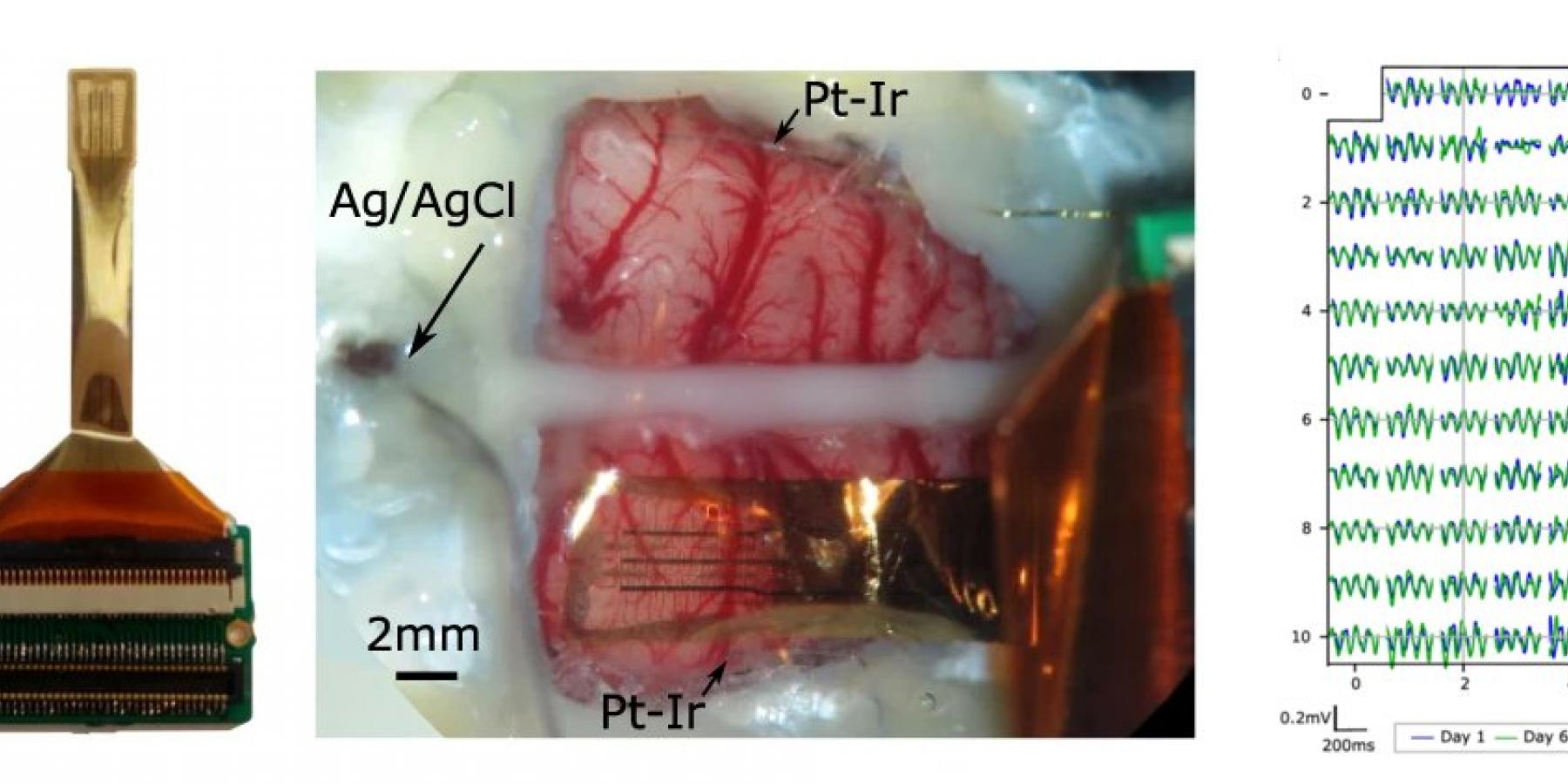 Graphene active sensor arrays for long-term and wireless mapping of wide frequency band epicortical brain activity