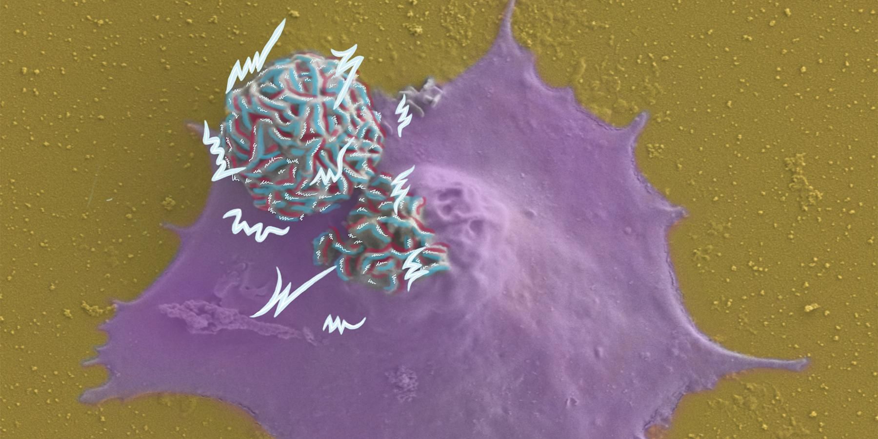 Imatge presa amb un Scanning Electron Microscope (SEM) i acolorida. El color vermell/blau representa el camp elèctric local que generen les nanofulles i el blanc són llamps d'electricitat. El morat és la cèl·lula i té dos microdispositius, un dins i un fora. IMB-CNM.