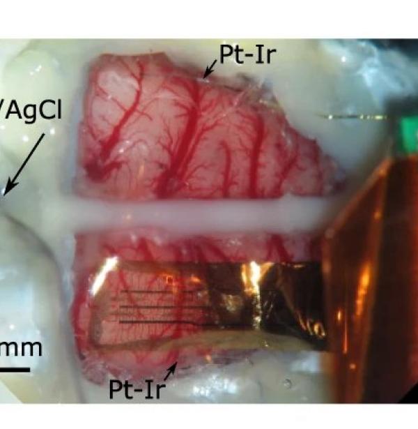 Graphene active sensor arrays for long-term and wireless mapping of wide frequency band epicortical brain activity