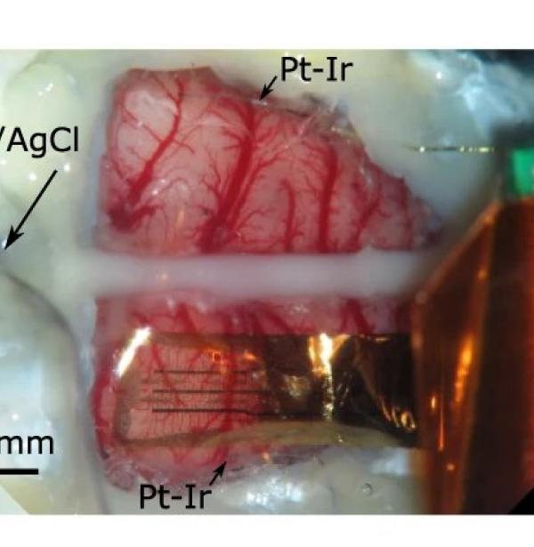 Graphene active sensor arrays for long-term and wireless mapping of wide frequency band epicortical brain activity